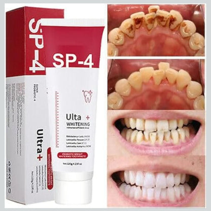 Original SP 4 Ultra Brightening Toothpaste Advanced Whitening Formula for Stain Removal and Enamel Protection-50 gm (Pack Of 2)